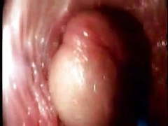 CrocoPost presents: Video from the inside of a vagina... very interesting